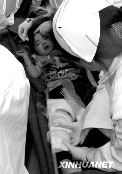 2008年5月14日，医务人员在救治宋欣宜。当日9时40分左右，北川县城，被压在垮塌的房屋下的三岁小女孩宋欣宜，在已经逝去的父母身体翼护下与死神抗争了四十余个小时后终于获救。